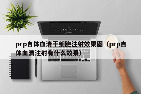 prp自体血清干细胞注射效果图（prp自体血清注射有什么效果）